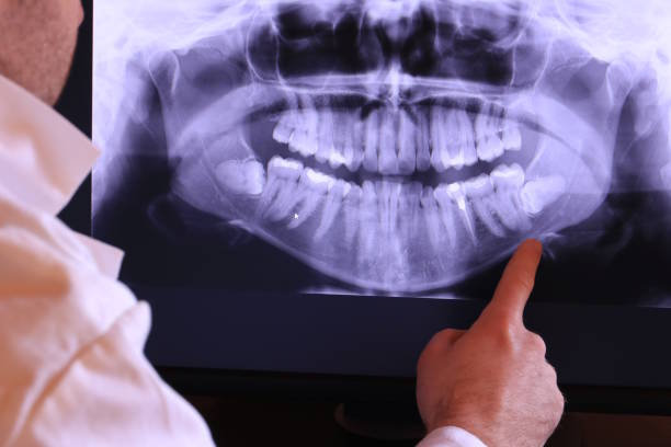 Urgent Tooth Repair in NV